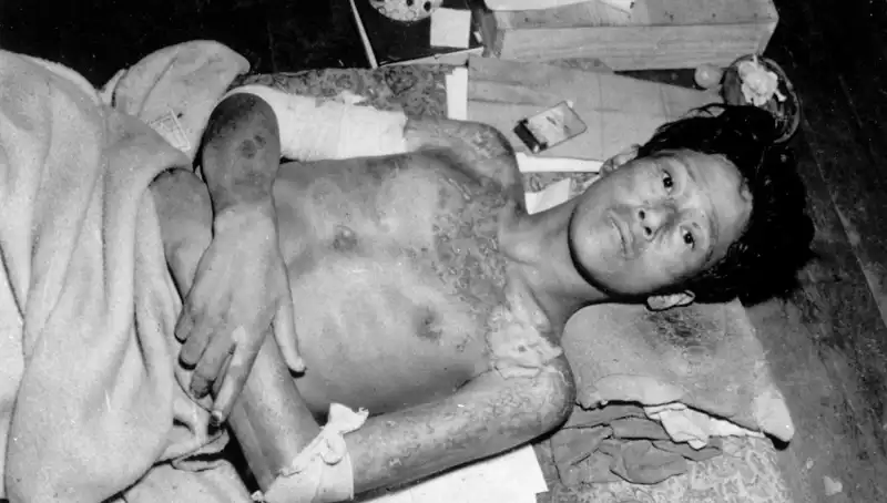 Nagasaki’den 80 Yıl Sonra Uyarı: Nükleer Felaket Riskimiz Artıyor!